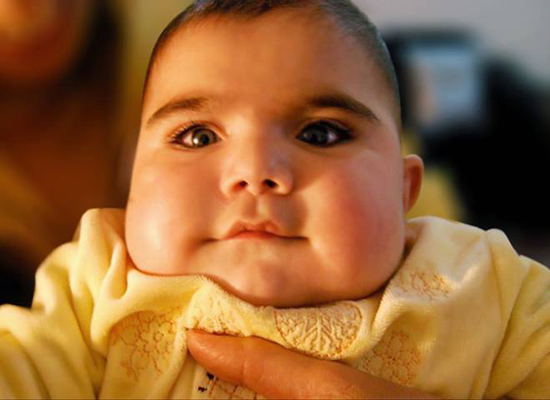 baby-Meron humanitarian-organization