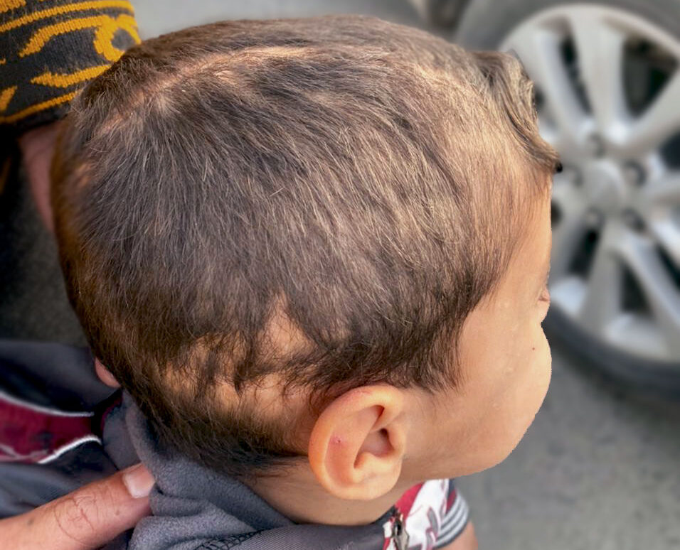 Veterans Rebuilding Life 2022 child medical mission to Mosul, Iraq. Veterans Rebuilding Life 2022 child medical mission to Mosul, Iraq.