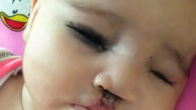 Baby medical patient, post surgery.